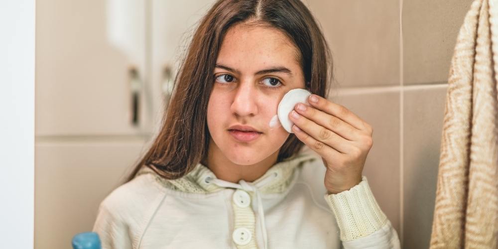 aiutare-un-figlio-con-acne